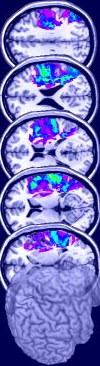 All about DICOM